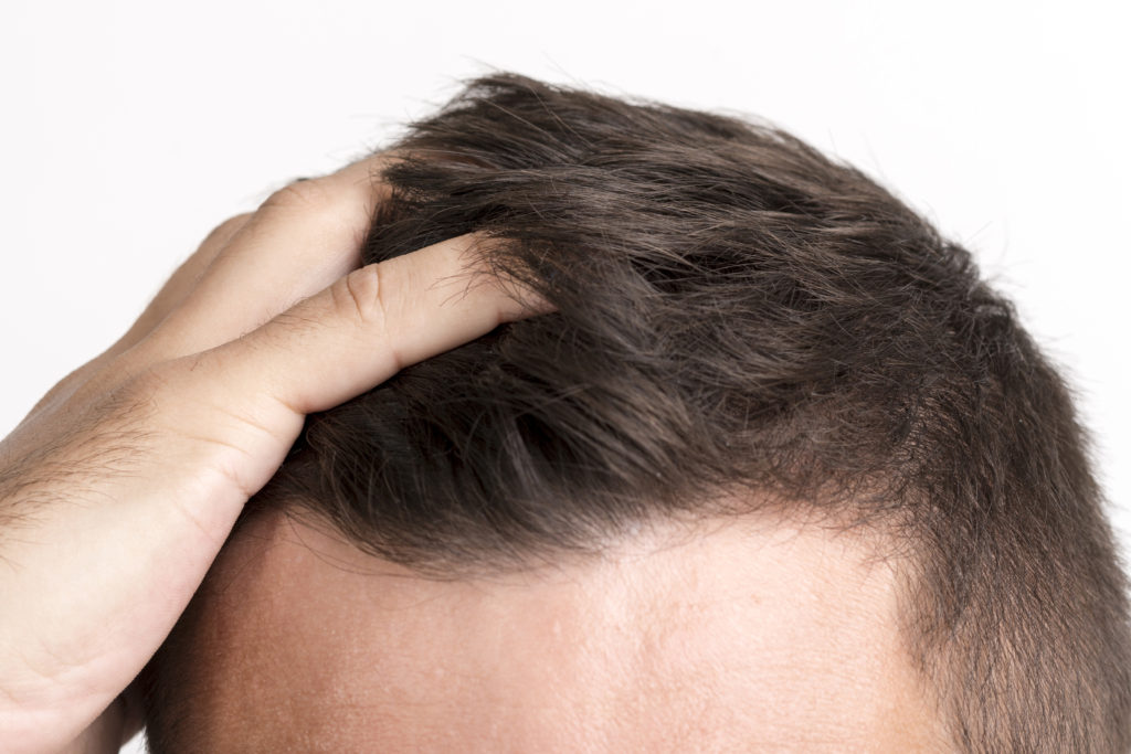 Medical treatments for hair loss - thepennybox.com